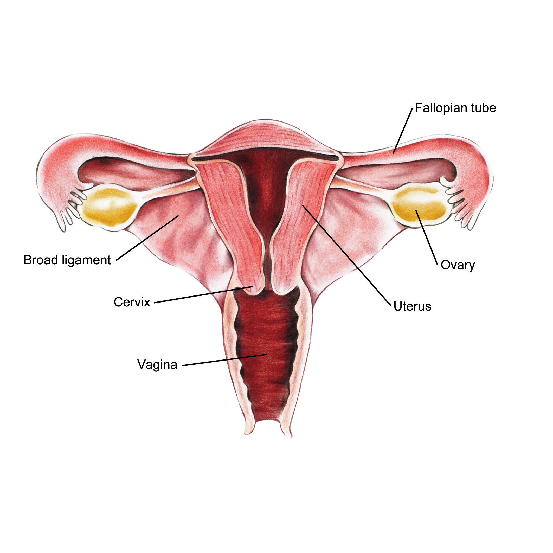 cancer endometrial tratament
